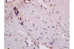 Formalin-fixed and paraffin embedded rat brain labeled with Rabbit Anti-MDGA2 Polyclonal Antibody, Unconjugated  at 1:200 followed by conjugation to the secondary antibody and DAB staining (MDGA2 Antikörper  (AA 751-850))