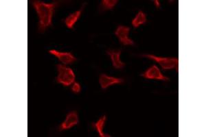 Immunofluorescence (fixed cells) (IF/ICC) image for anti-Progesterone Receptor (PGR) antibody (ABIN6264437)