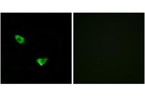 Immunofluorescence analysis of MCF7 cells, using CHSY2 Antibody.