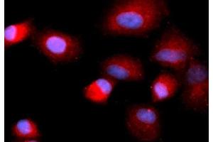 Immunofluorescence (IF) image for anti-Cofilin 1 (CFL1) (AA 1-166) antibody (APC) (ABIN5566999) (Cofilin Antikörper  (AA 1-166) (APC))