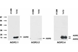 Western blotting analysis of AGR3 protein by AGR3. (AGR2+AGR3 Antikörper)