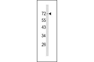 Western blot analysis of Merlin Antibody (N-term) (ABIN390756 and ABIN2841014) in NCI- cell line lysates (35 μg/lane). (Merlin Antikörper  (N-Term))