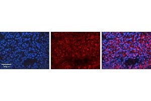 Rabbit Anti-BRCA1 Antibody Catalog Number: ARP30434_P050 Formalin Fixed Paraffin Embedded Tissue: Human Lymph Node Tissue Observed Staining: Cytoplasm Primary Antibody Concentration: 1:100 Other Working Concentrations: N/A Secondary Antibody: Donkey anti-Rabbit-Cy3 Secondary Antibody Concentration: 1:200 Magnification: 20X Exposure Time: 0. (BRCA1 Antikörper  (N-Term))