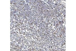 IHC analysis of MCM7 using anti-MCM7 antibody (ABIN7601968). (MCM7 Antikörper  (AA 526-719))