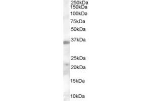 Western Blotting (WB) image for anti-Calcium Channel, Voltage-Dependent, alpha 2/delta Subunit 4 (CACNA2D4) (Middle Region) antibody (ABIN2790200) (CACNA2D4 Antikörper  (Middle Region))