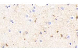 Immunohistochemistry (IHC) image for anti-Glutamine Synthetase (GLN1) (AA 1-373) antibody (ABIN7435589)