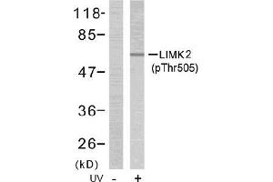 Image no. 1 for anti-LIM Domain Kinase 2 (LIMK2) (pThr505) antibody (ABIN196832) (LIMK2 Antikörper  (pThr505))