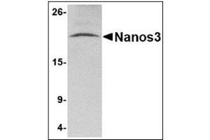 Western blot analysis of Nanos3 in human brain tissue lysate with Nanos3 antibody at 2 µg/ml.