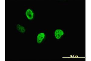 Immunofluorescence of monoclonal antibody to CUTL1 on HeLa cell.