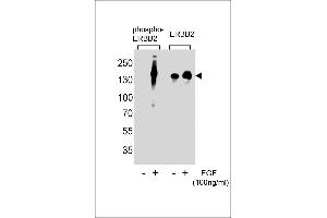 Western blot analysis of extracts from A431 cells,untreated or treated with EGF,100 ng/mL , using phospho-ERBB2-(left) or ERBB2 Antibody (right) (ErbB2/Her2 Antikörper  (pTyr1248))