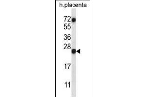 RNASE8 Antibody (C-term) (ABIN657386 and ABIN2846428) western blot analysis in human placenta tissue lysates (35 μg/lane). (RNASE8 Antikörper  (C-Term))