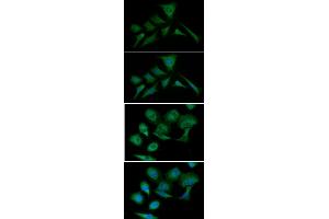 ICC/IF analysis of PKM2 in HeLa cells line, stained with DAPI (Blue) for nucleus staining and monoclonal anti-human PKM2 antibody (1:100) with goat anti-mouse IgG-Alexa fluor 488 conjugate (Green). (PKM Antikörper  (AA 1-531))