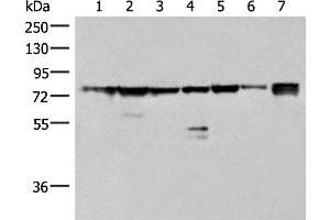 Western blot analysis of 231 K562 TM4 cell Mouse kidney tissue Mouse liver tissue Mouse brain tissue Hela cell lysates using THNSL1 Polyclonal Antibody at dilution of 1:500 (THNSL1 Antikörper)