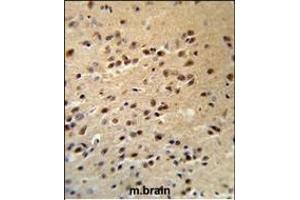 ALS2 Antibody (C-term) (R) IHC analysis in formalin fixed and paraffin embedded human brain tissue followed by peroxidase conjugation of the secondary antibody and DAB staining. (ALS2 Antikörper  (C-Term))