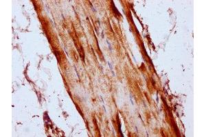 IHC image of ABIN7158674 diluted at 1:300 and staining in paraffin-embedded human skeletal muscle tissue performed on a Leica BondTM system. (LYRM4 Antikörper  (AA 1-91))