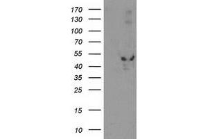 Western Blotting (WB) image for anti-Eukaryotic Translation Initiation Factor 2B, Subunit 3 Gamma, 58kDa (EIF2B3) antibody (ABIN1497968) (EIF2B3 Antikörper)