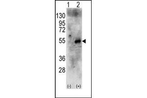 Image no. 1 for anti-Ribosomal Protein S6 Kinase, 70kDa, Polypeptide 2 (RPS6KB2) (Middle Region) antibody (ABIN360434) (RPS6KB2 Antikörper  (Middle Region))