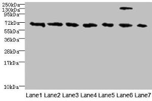Western blot All lanes: TRPM2 antibody at 3 μg/mL Lane 1: HepG2 whole cell lysate Lane 2: Mouse brain tissue Lane 3: A549 whole cell lysate Lane 4: K562 whole cell lysate Lane 5: Mouse kidney tissue Lane 6: Human placenta tissue Lane 7: Mouse spleen tissue Secondary Goat polyclonal to rabbit IgG at 1/10000 dilution Predicted band size: 172, 166, 96 kDa Observed band size: 70 kDa (TRPM2 Antikörper  (AA 60-119))