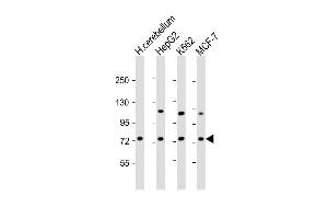 Western Blot at 1:2000 dilution Lane 1: human cerebellum lysate Lane 2: HepG2 whole cell lysate Lane 3: K562 whole cell lysate Lane 4: MCF-7 whole cell lysate Lysates/proteins at 20 ug per lane. (SMPD1 Antikörper  (C-Term))