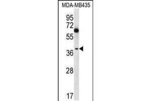 Western blot analysis in MDA-MB435 cell line lysates (35ug/lane). (NFKBIL1 Antikörper  (C-Term))