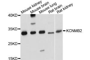 Western blot analysis of extract of various cells, using KCNMB2 antibody.