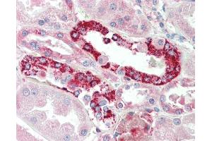 Anti-PRK / PLK3 antibody IHC staining of human kidney. (PLK3 Antikörper  (AA 320-333))