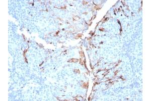 Immunohistochemistry (IHC) image for anti-Mesothelin (MSLN) (AA 273-407) antibody (ABIN7504135)