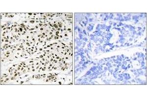 Immunohistochemistry (IHC) image for anti-Vacuolar Protein Sorting 72 Homolog (S. Cerevisiae) (VPS72) (AA 131-180) antibody (ABIN1533927)