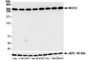 Western Blotting (WB) image for anti-Mediator Complex Subunit 12 (MED12) (AA 2127-2177) antibody (ABIN7453977) (Rekombinanter MED12 Antikörper  (AA 2127-2177))
