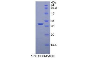 SDS-PAGE (SDS) image for Insulin-Like Growth Factor 2 Receptor (IGF2R) (AA 1148-1365) protein (His tag) (ABIN1879437)