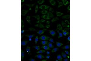 Immunofluorescence analysis of L929 cells using NDUFB7 Polyclonal Antibody (ABIN6132403, ABIN6144480, ABIN6144481 and ABIN6217781) at dilution of 1:100 (40x lens). (NDUFB7 Antikörper  (AA 1-137))
