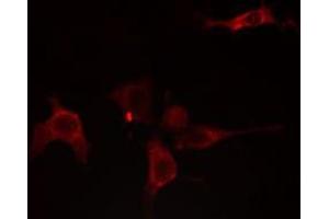 ABIN6275754 staining NIH-3T3 cells by IF/ICC. (GNE Antikörper)