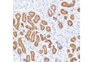 Immunohistochemistry (IHC) image for anti-Signal Transducer and Activator of Transcription 5A (STAT5A) (AA 744-794) antibody (ABIN7454017) (Rekombinanter STAT5A Antikörper  (AA 744-794))
