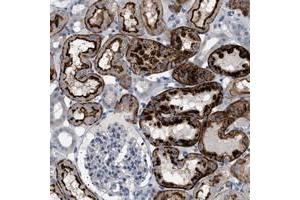 Immunohistochemical staining of human kidney with ADCY10 polyclonal antibody  shows strong positivity in tubuli at 1:20-1:50 dilution. (ADCY10 Antikörper)