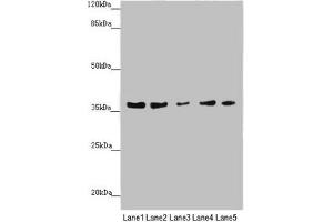 Western blot All lanes: MTHFD2 antibody at 4.