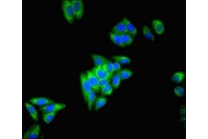 Immunofluorescent analysis of HepG2 cells using ABIN7149659 at dilution of 1:100 and Alexa Fluor 488-congugated AffiniPure Goat Anti-Rabbit IgG(H+L)
