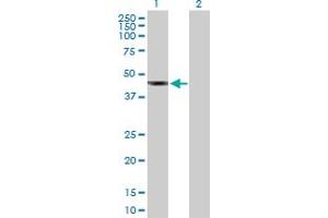 Western Blot analysis of SUDS3 expression in transfected 293T cell line by SUDS3 MaxPab polyclonal antibody.