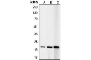 Western blot analysis of RPL10 expression in K562 (A), MCF7 (B), Ramos (C) whole cell lysates.