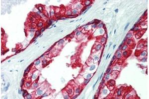 Prostate, Human: Formalin-Fixed, Paraffin-Embedded (FFPE) (Cytokeratin 19 Antikörper  (C-Term))