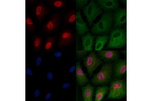 ABIN6258395 and ABIN6275065 staining  cells by IF/ICC. (TdT Antikörper  (Internal Region))