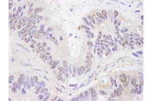 Immunohistochemistry (IHC) image for anti-BCL2-Associated Transcription Factor 1 (BCLAF1) (AA 150-200) antibody (ABIN7448448) (BCLAF1 Antikörper  (AA 150-200))