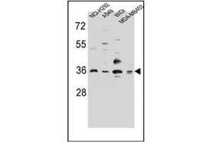 Western blot analysis of RIC3 Antibody (C-term) in NCI-H292,A549,WiDr,MDA-MB453 cell line lysates (35ug/lane). (RIC3 Antikörper  (C-Term))