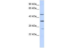 WB Suggested Anti-MEF2B Antibody Titration:  0. (MEF2B Antikörper  (N-Term))