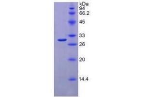 SDS-PAGE analysis of Mouse IFNa/bR1 Protein. (IFNAR1 Protein)