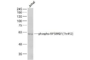 Jurkat lysates probed with RPS6KB1(Thr412) Polyclonal Antibody, Unconjugated  at 1:300 dilution and 4˚C overnight incubation. (RPS6KB1 Antikörper  (pThr412))