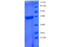 Chemokine (C-C Motif) Ligand 5 (CCL5) (AA 24-91), (full length) protein (GST tag) (CCL5 Protein (AA 24-91, full length) (GST tag))