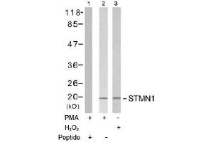 Image no. 2 for anti-Stathmin 1 (STMN1) (Ser15) antibody (ABIN197474) (Stathmin 1 Antikörper  (Ser15))