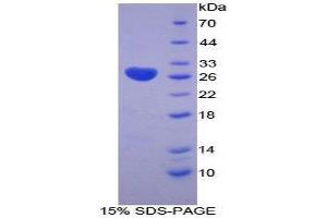 SDS-PAGE (SDS) image for Lysyl Oxidase-Like 3 (LOXL3) (AA 519-726) protein (His tag) (ABIN1879784)