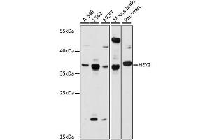 Western blot analysis of extracts of various cell lines, using HEY2 antibody (ABIN6294032) at 1:1000 dilution.