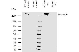 Western Blotting (WB) image for anti-Tenascin C (TNC) antibody (ABIN94480)